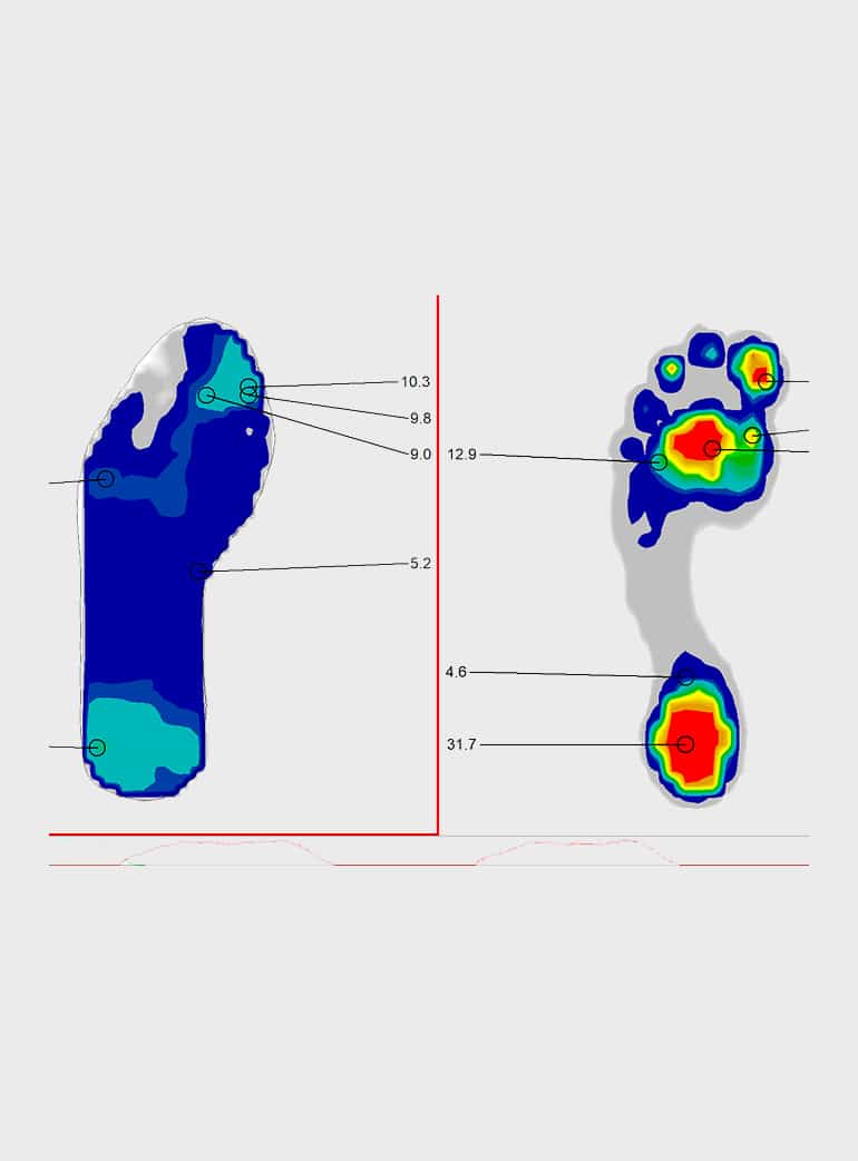 Digitale Fußdruckmessung in Gießen und Buseck bei Pfeiffer Orthopädie-Schuhtechnik